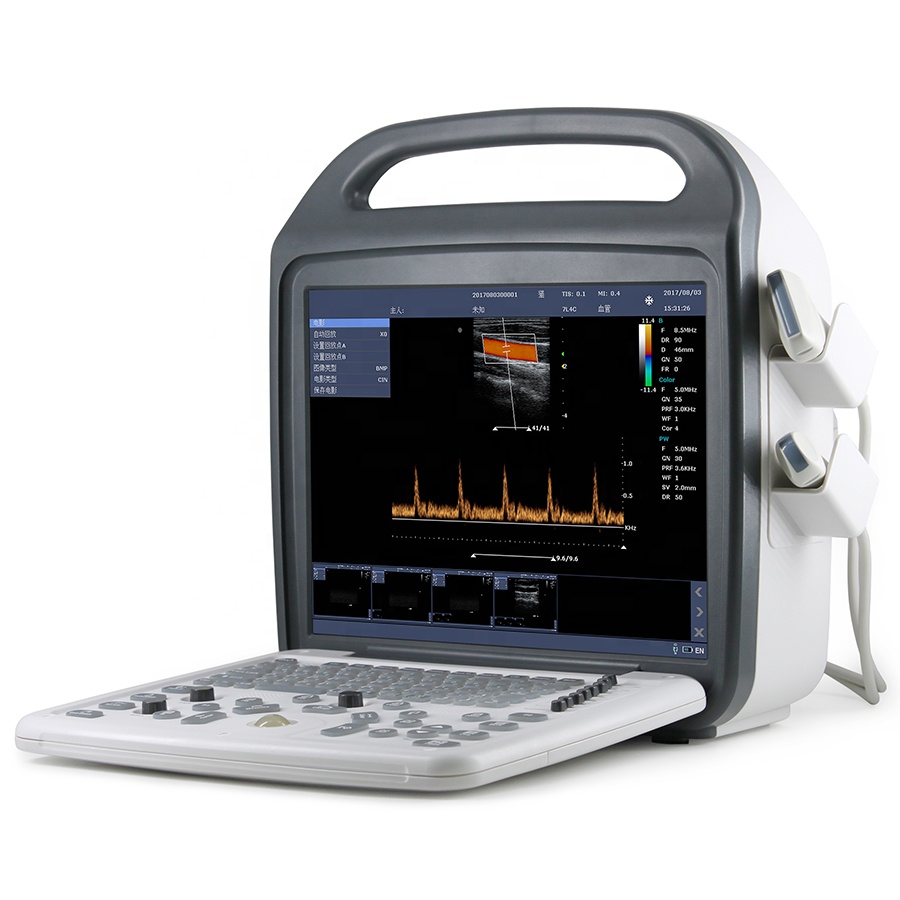 Mindray 3d/4d Color Doppler Ultrasound