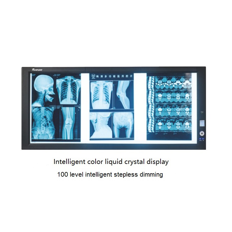 ZG-3 Medical Intelligent color display analog /high density digital x ray molybdenum target breast negatoscope LCD/LED film viewer