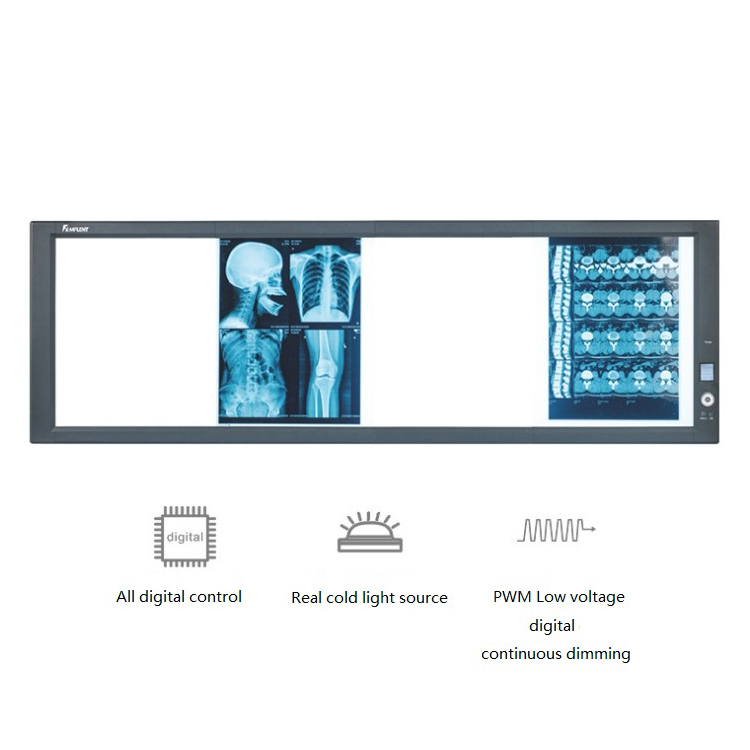 ZG-4 Medical Intelligent color liquid crystal display analog /high density digital x ray molybdenum target breast LCD/LED film viewer