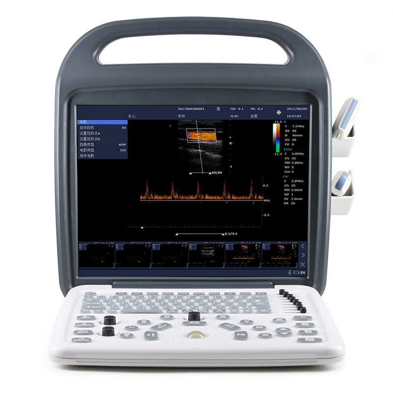 DCU7-V 15 Inch LCD Display High Resolution Digital Color Fetal Doppler Monitor Hospital Medical Ultrasound Therapy Machine