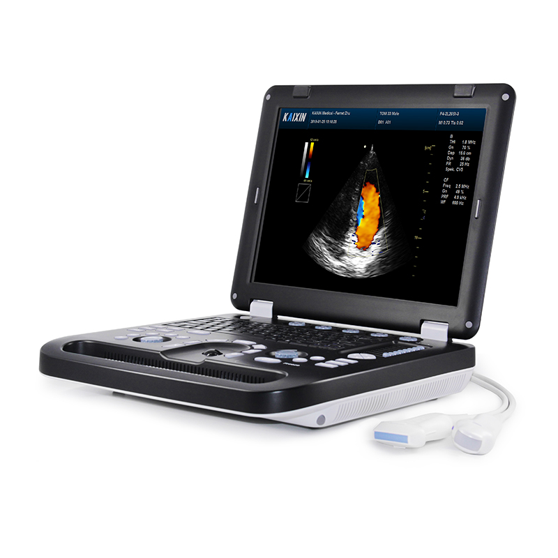 Kaixin DCU30 Full Digital Color Doppler Ultrasound Scanner with 80 Elements Probe