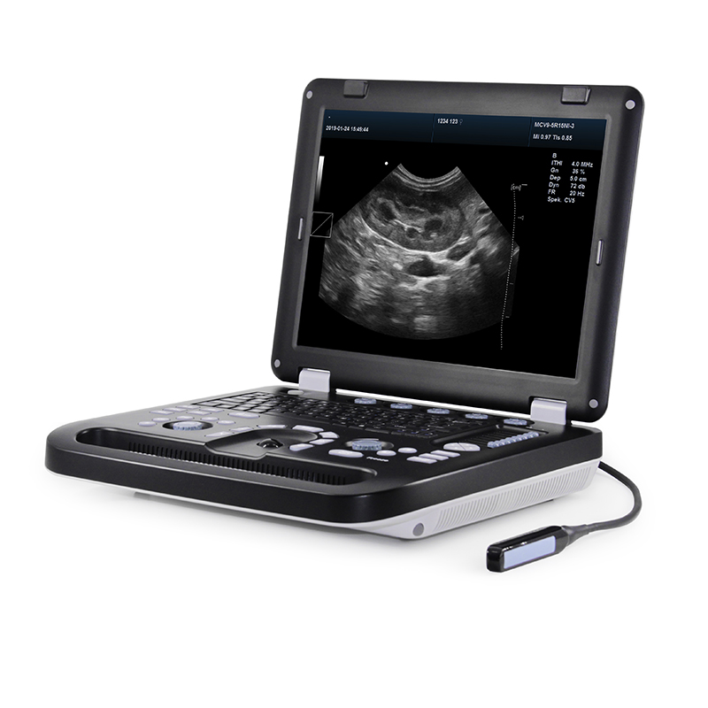 Kaixin DCU30-V Full Digital Color Doppler Ultrasound Scanner with 80 Elements Probe