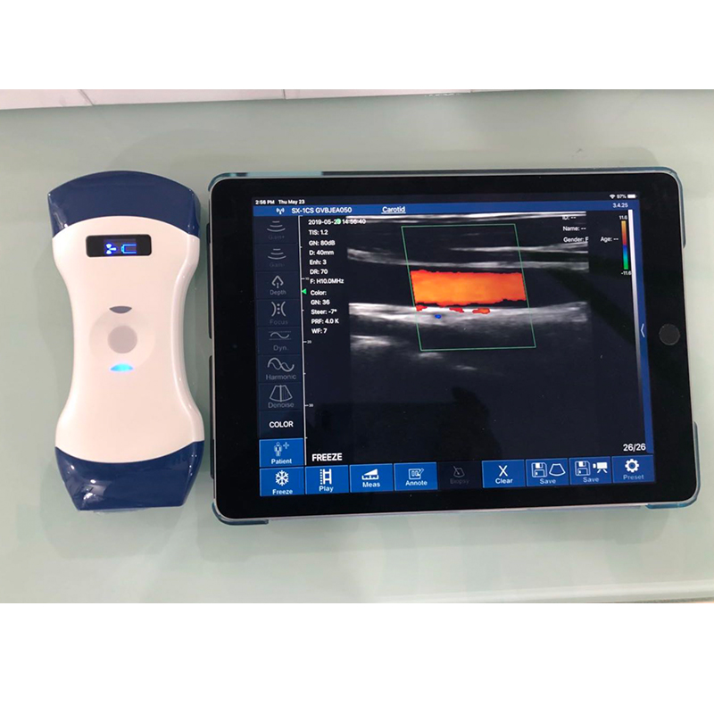 CProbe-5CL Color Doppler Ultrasound Wifi Wireless Ultrasound Probe 128 Elements Convex Linear Wireless Probe Ultrasound