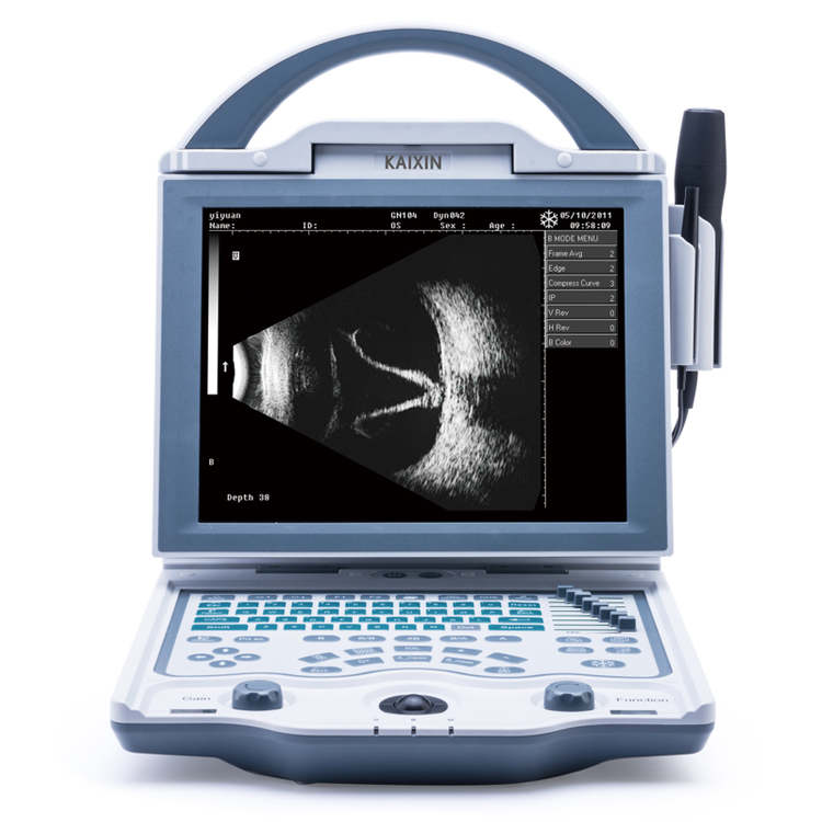 ODU5 Ultrasound A-Scan Biometer with Pachymeter