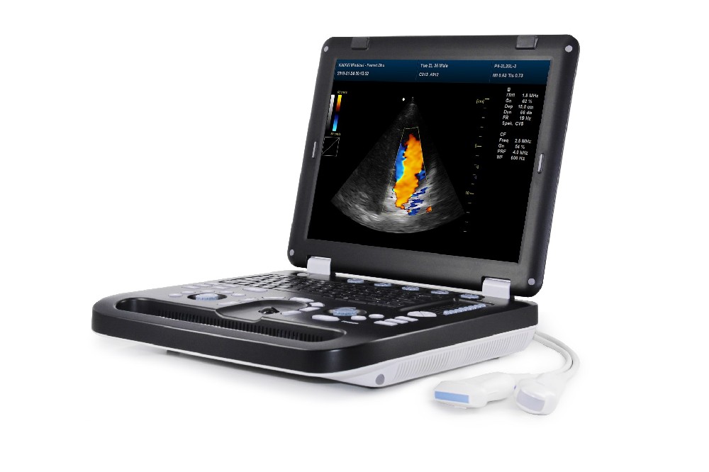 DCU30 4D doppler Portable Ultrasound Scanner