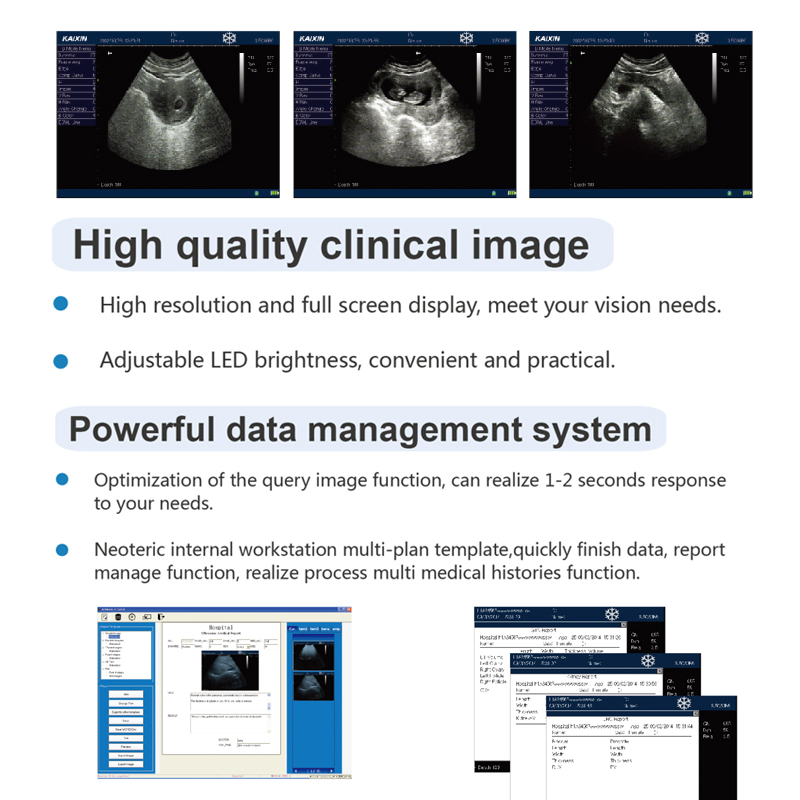 B ultrasound machines.jpg