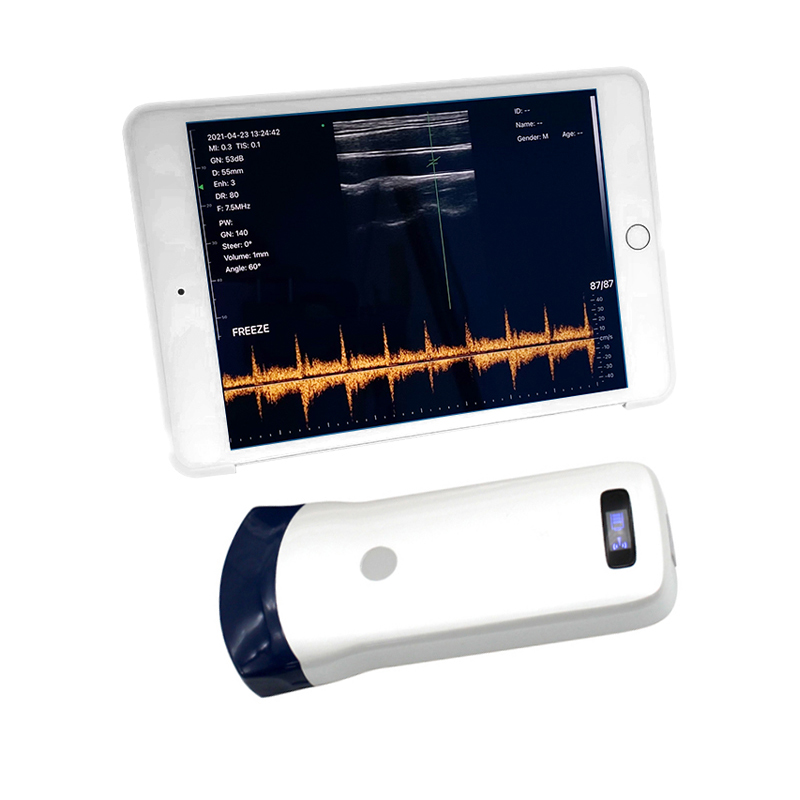 Good Price Medical 3 In 1 Handheld Portable Diagnostic Ultrasound Machine In Dubai WJ-CProbe-5L